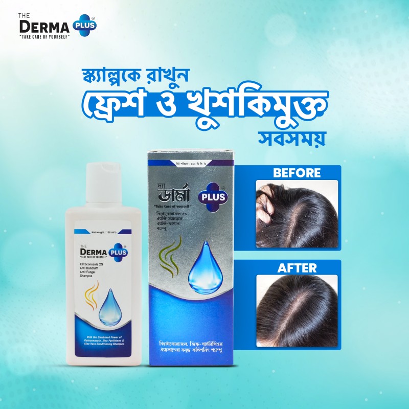 The Derma Plus Ketoconazole 2% Anti‑Dandruff & Anti‑Fungal Shampoo – 100 ml
